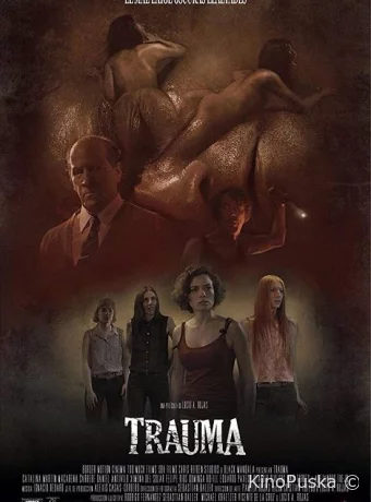 Травма 